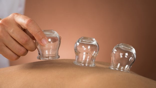 Cupping Therapy to relieve muscle tension, improve overall blood flow and promote cell repair.