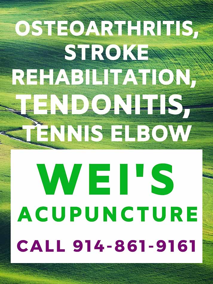 From acute pain relief to holistic healing – FCT Family Acupuncture is your sanctuary.