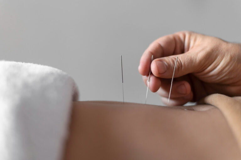 Comparing Acupuncture and Intravenous Morphine for Acute Pain Relief in the ED