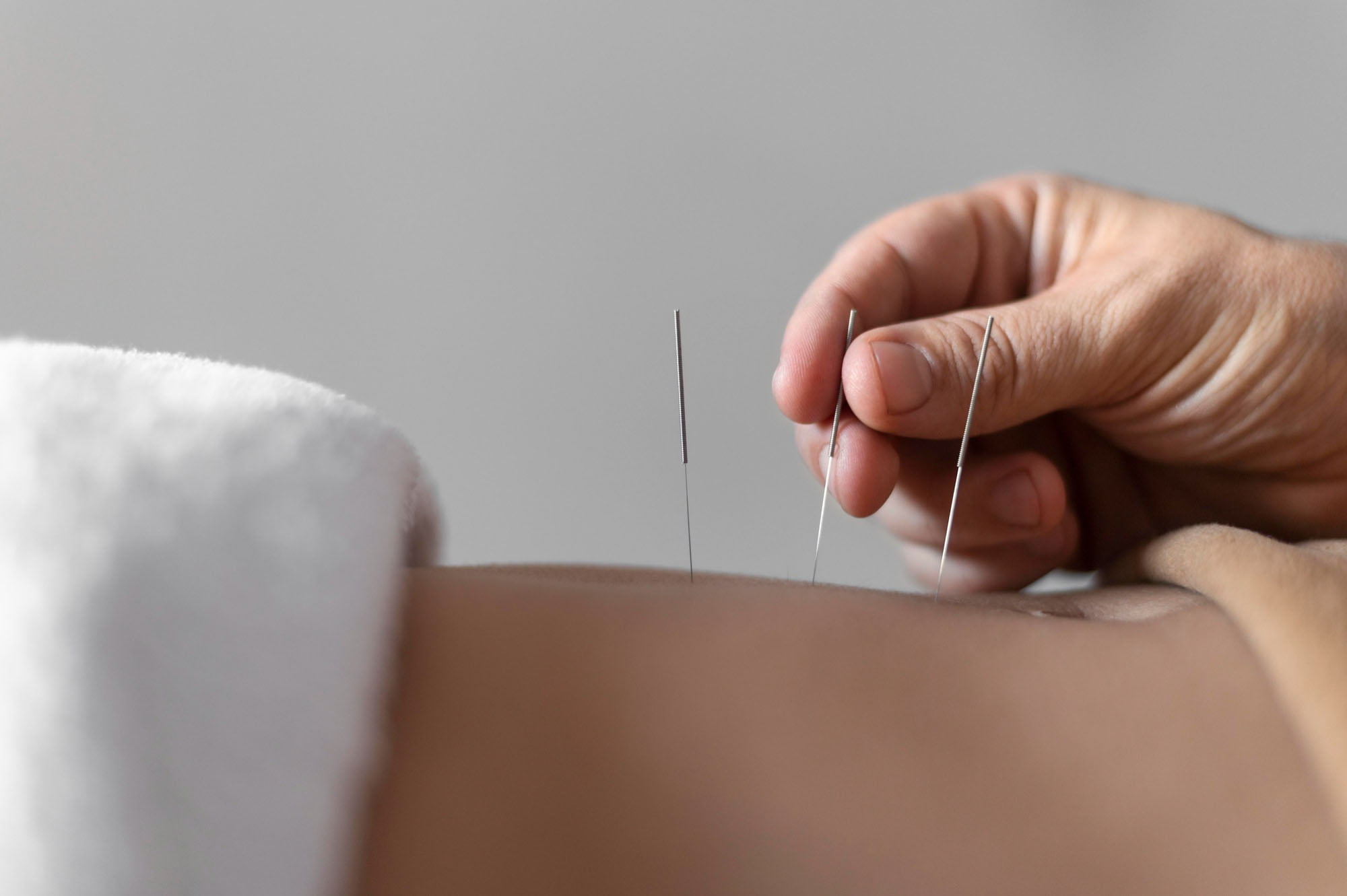 acupuncture and morphine