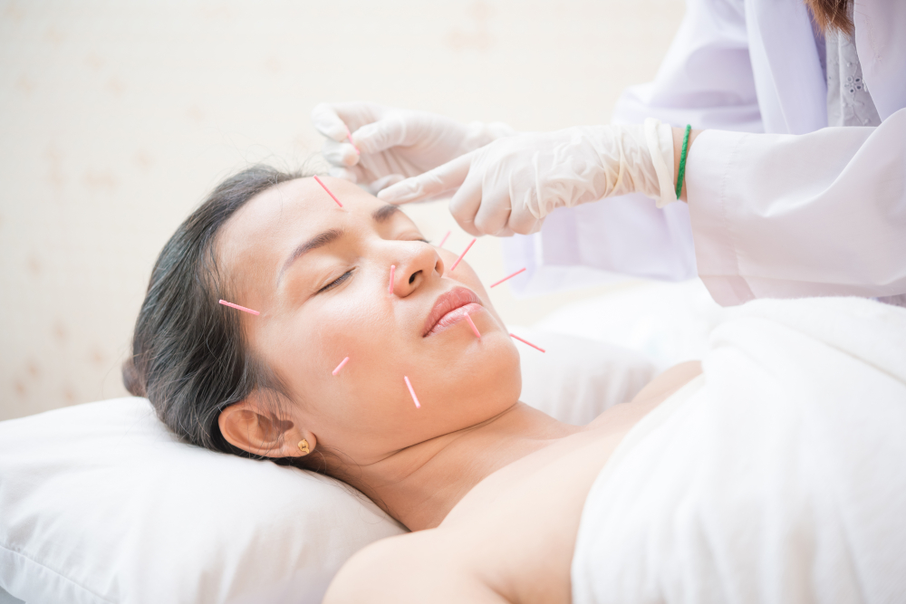 Acupuncture for Facial Rejuvenation Westchester County, NY