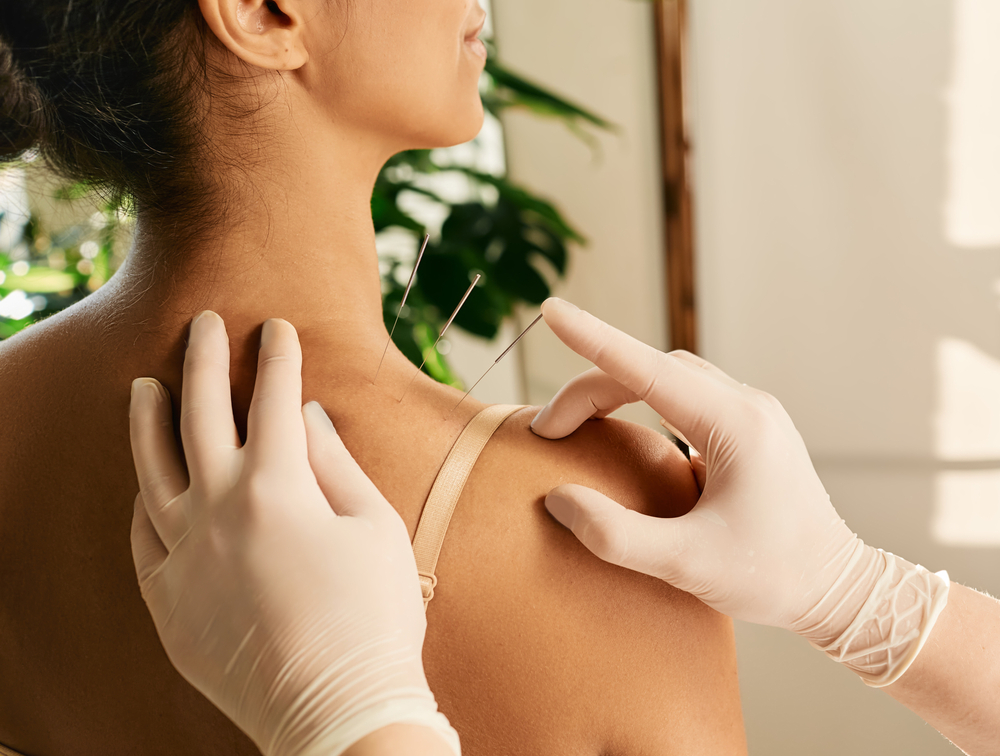 Acupuncture for Shoulder pain Mount Kisco, NY