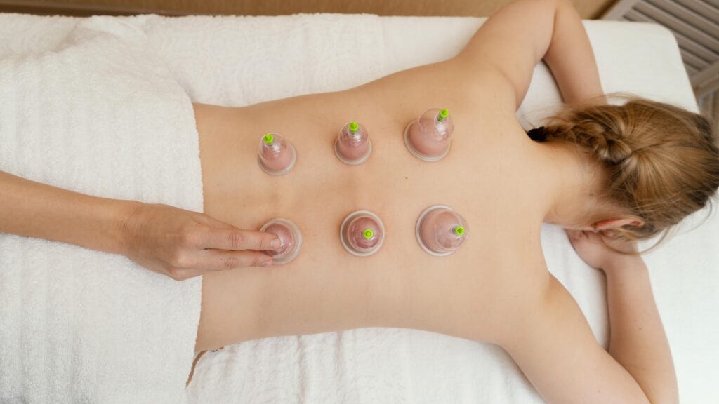 Cupping Therapy in Westchester NY