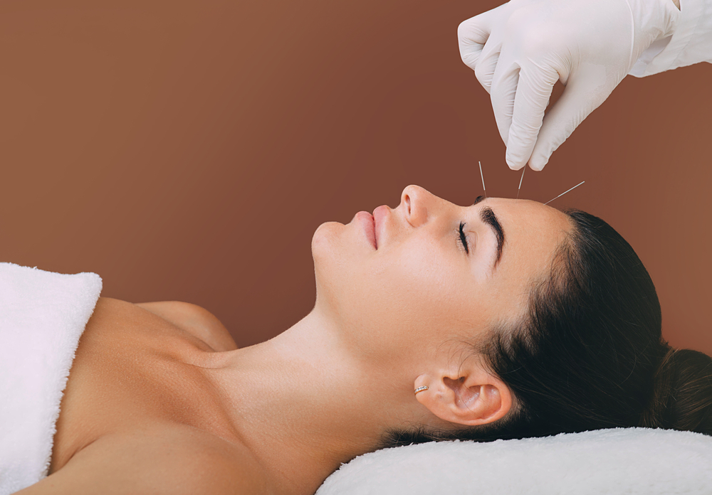 Acupuncture Services in Mount Kisco NY