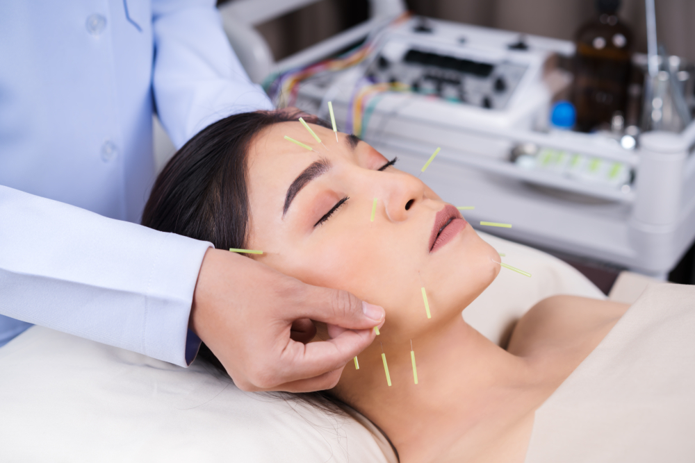 Acupuncture for Facial Rejuvenation in Westchester County NY