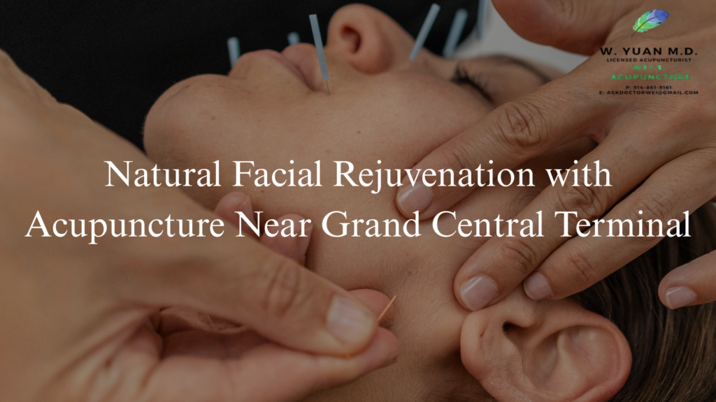 Acupuncture for Facial Rejuvenation Grand Central Terminal