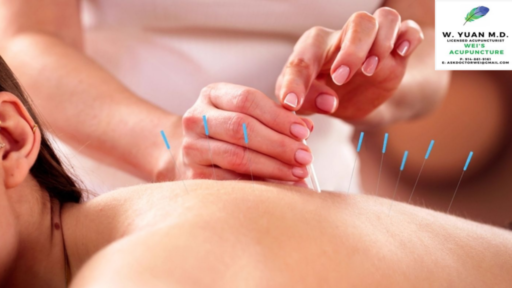 Acupuncture Clinic in Midtown NYC