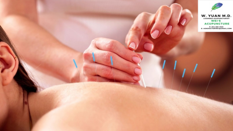 Acupuncture Clinic in Midtown NYC