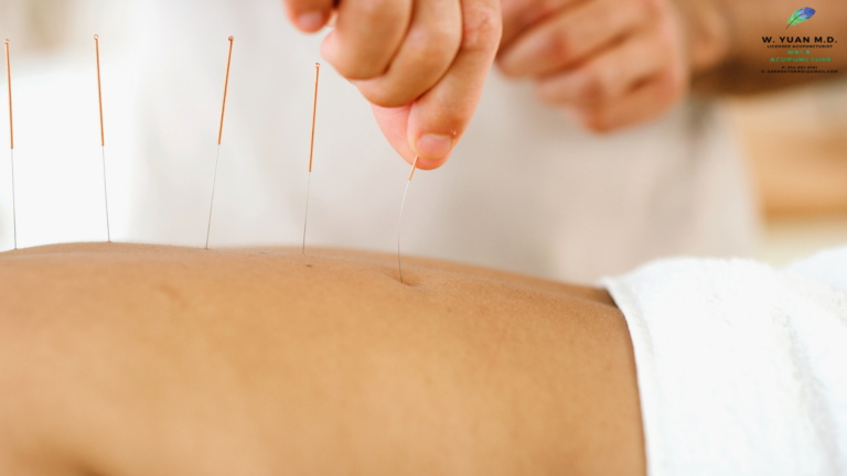 Acupuncture for Lower Back Pain in Westchester NY