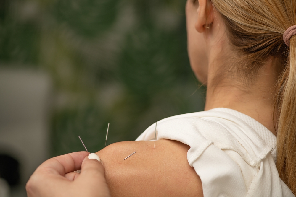 Acupuncture for Shoulder Pain
