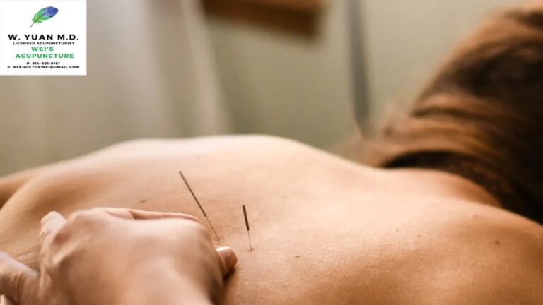 Best Acupuncture Clinic Grand Central Terminal NY